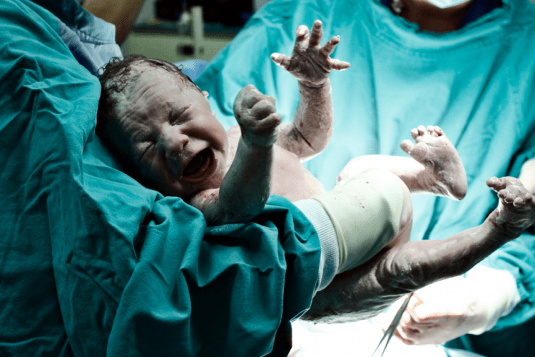 Czym grozi niedotlenienie noworodka po porodzie