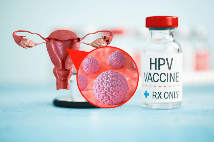 Szczepionka przeciwko HPV refundowana